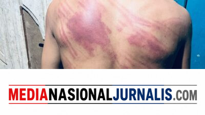 Prof. Sutan Nasomal Minta Kapolda Sultra Perintahkan Kapolres Kolaka Usut Transparan Dugaan Penganiayaan